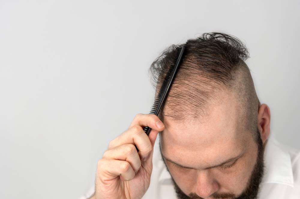 What Causes Thinning Hair in Men? | Affordable Men's Haircuts